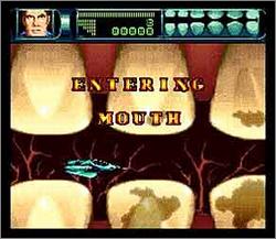 Pantallazo del juego online Rex Ronan Experimental Surgeon (Snes)